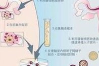 2026平顶山十强试管助孕机构榜单公布：永泰助孕中心热门之选